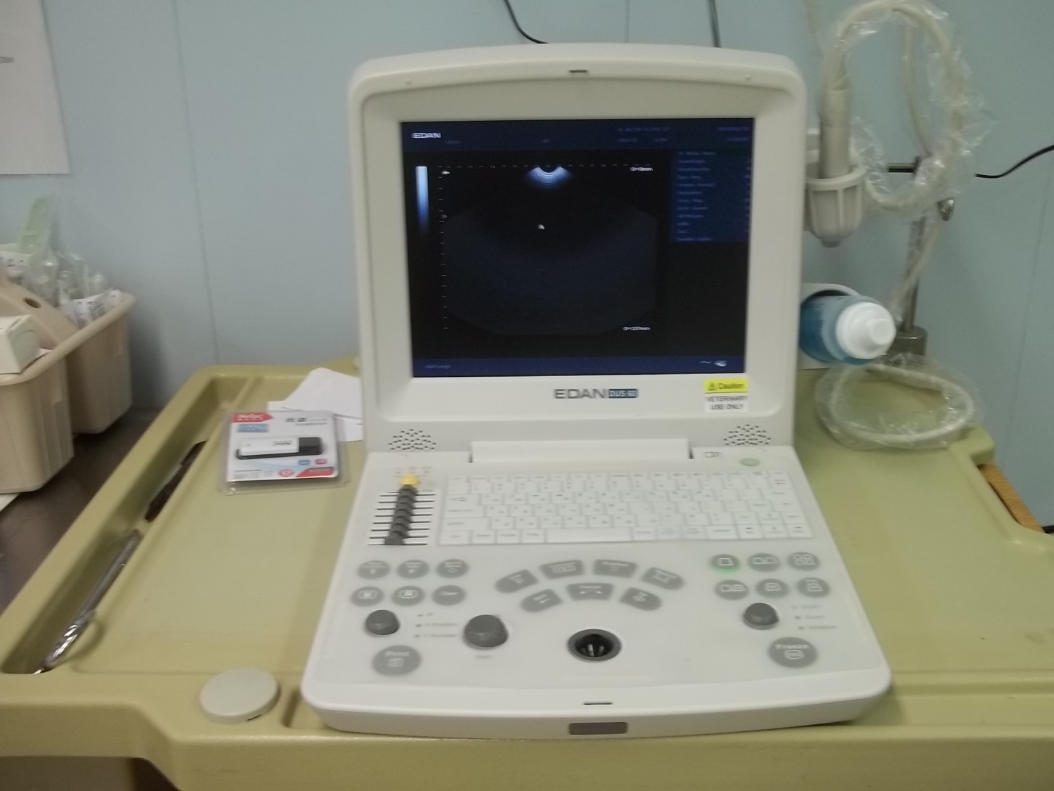 Ultrasound Machine